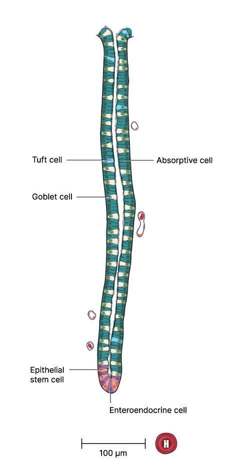 Depiction of intestinal tuft cell